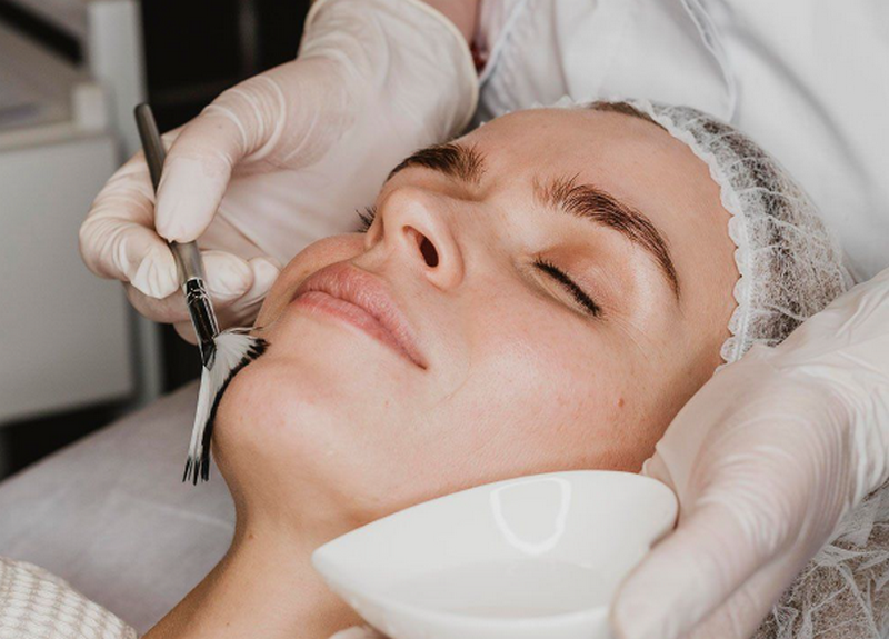 Peel da có tốt không? Ưu nhược điểm & lưu ý cần biết trước khi làm