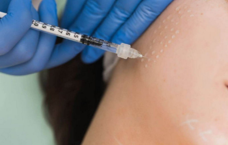 Rejuran S là chất gì? Tác dụng và những lưu ý an toàn