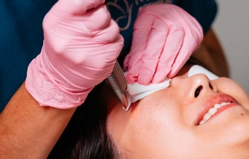Tổng quan về công nghệ laser Fotona: Công dụng, ưu nhược điểm, có an toàn?