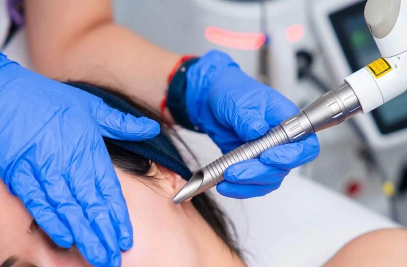 Tổng quan về công nghệ laser Fotona: Công dụng, ưu nhược điểm, có an toàn?