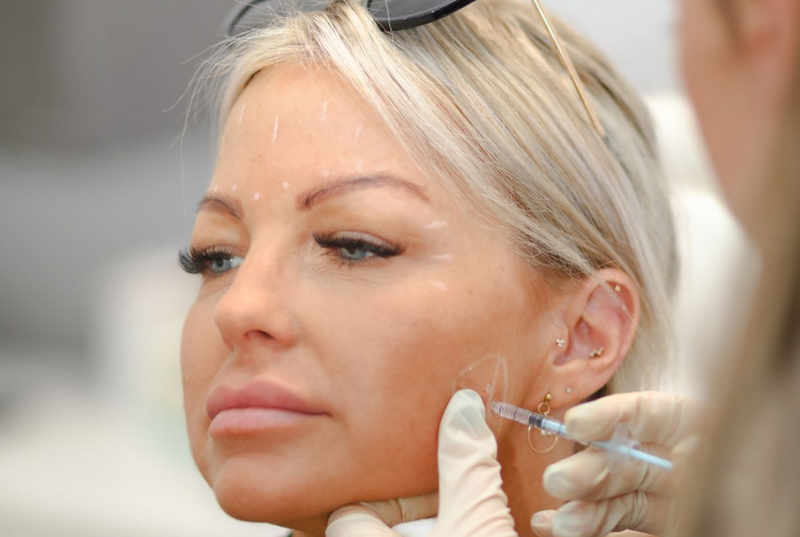 Filler là gì? Cơ chế, tác dụng và ưu nhược điểm