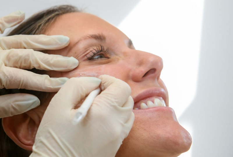 Filler là gì? Công dụng, thành phần, có an toàn không?