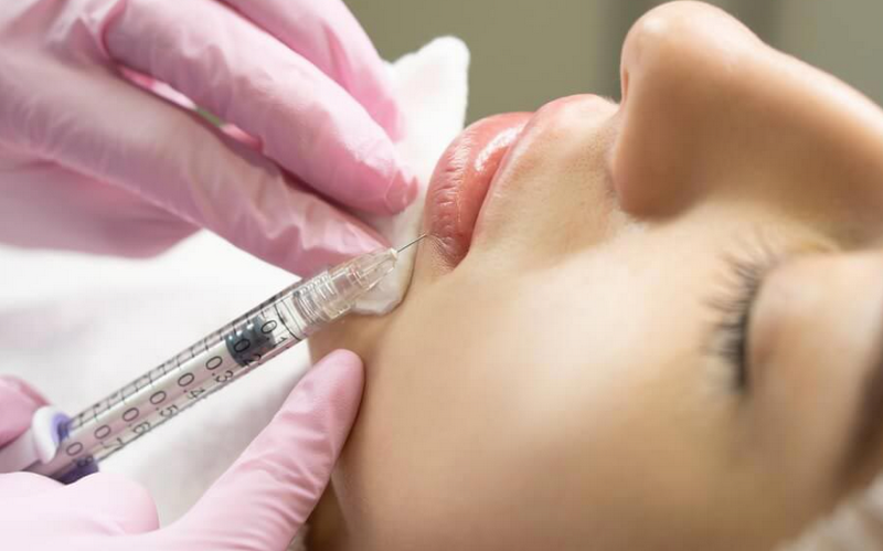 Môi cherry là gì? Các cách tạo môi cherry