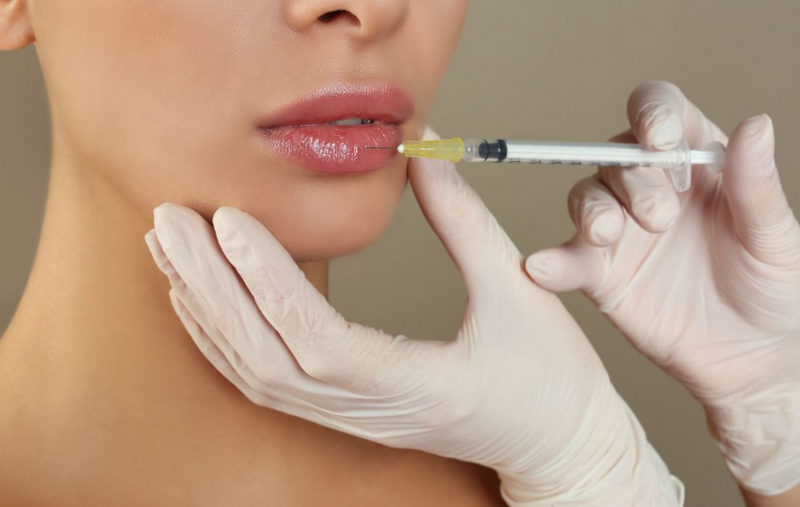 Môi chẻ là gì? Đặc điểm nhận biết và góc nhìn thẩm mỹ hiện đại