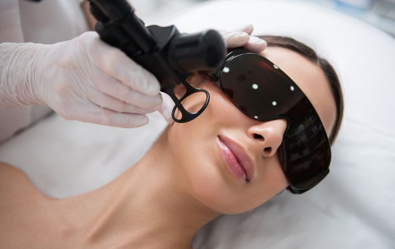 Chăm sóc da sau laser CO2, những điều nên và không nên làm