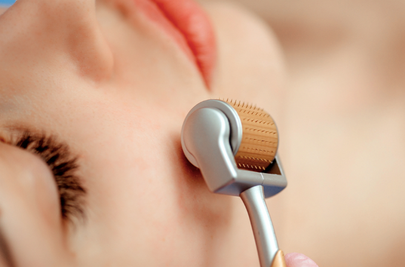 Lăn kim trị nám có tốt không? Có nên làm không?