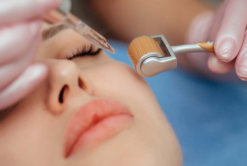 Lăn kim trị nám có tốt không? Có nên làm không?