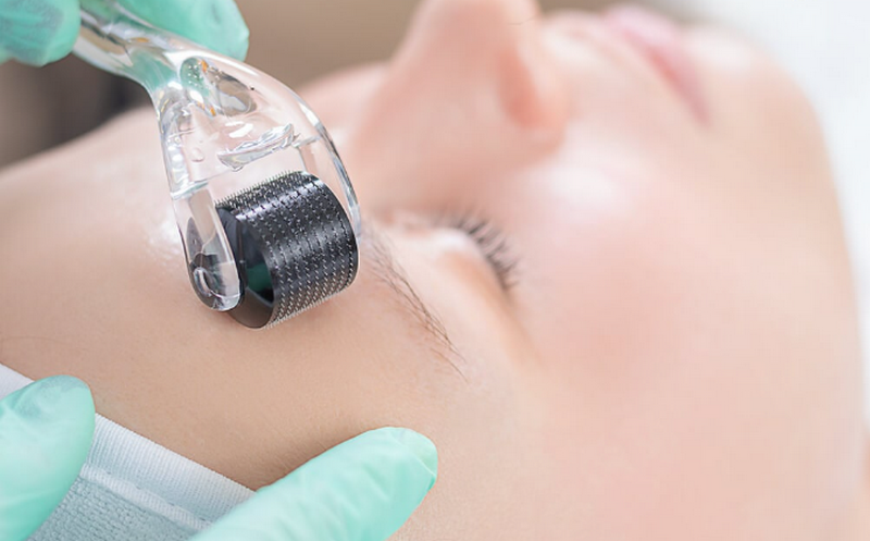 Chăm sóc da sau lăn kim giúp da phục hồi nhanh và hạn chế biến chứng