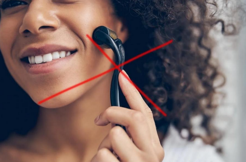 Lăn kim tại nhà có an toàn? Vì sao bác sĩ không khuyến khích?