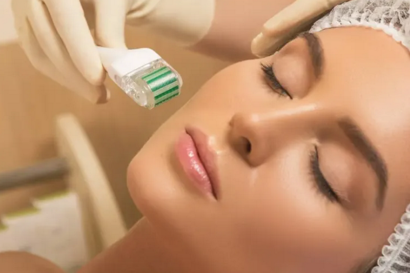 Có nên lăn kim không? Bác sĩ da liễu phân tích lợi ích và rủi ro
