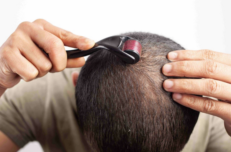 Có nên lăn kim không? Bác sĩ da liễu phân tích lợi ích và rủi ro