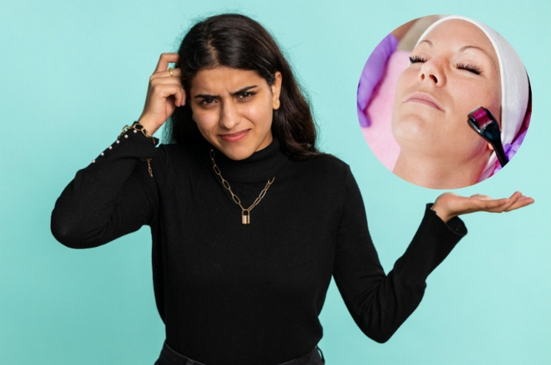 Có nên lăn kim không? Bác sĩ da liễu phân tích lợi ích và rủi ro