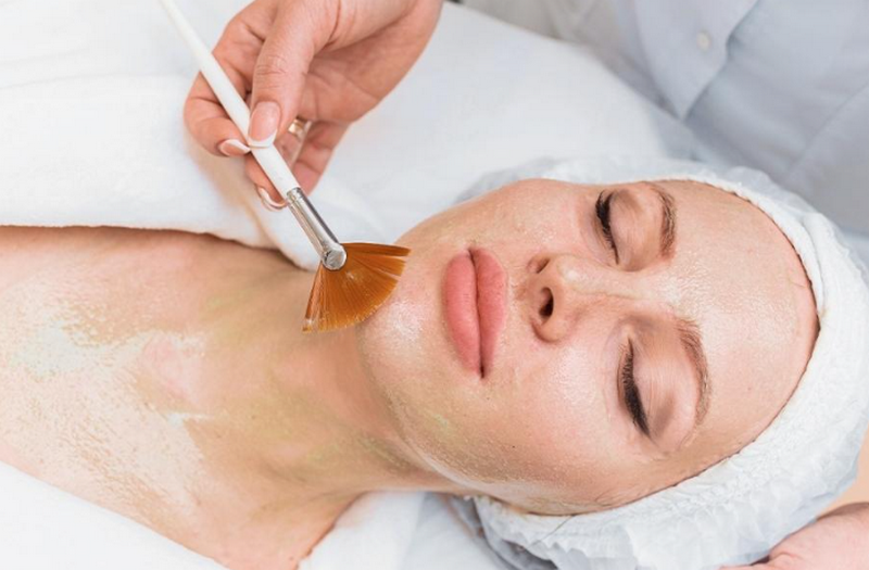 Peel da trị mụn có hiệu quả không? Cơ chế, lợi ích và những lưu ý