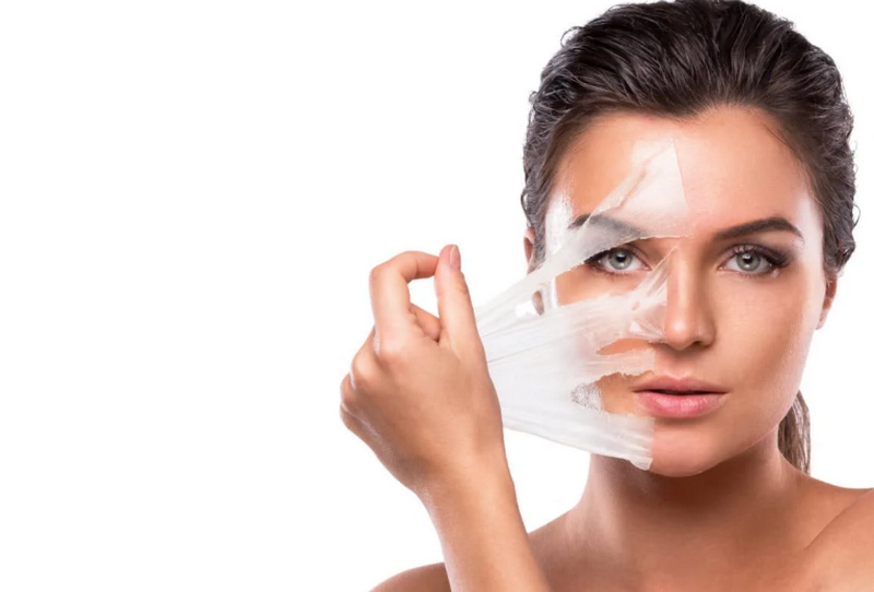 Peel da trị nám như thế nào? Cần lưu ý gì?