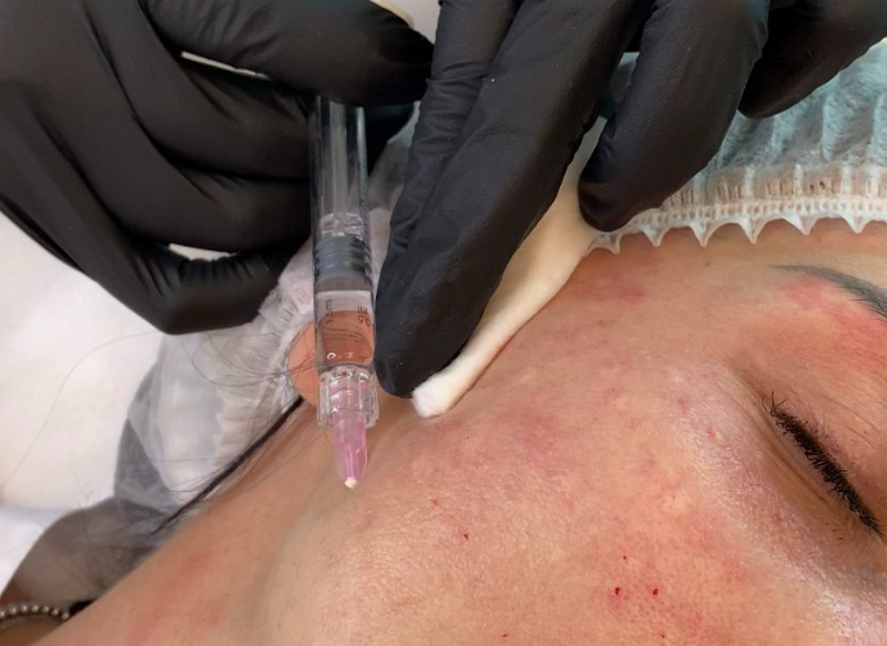 Jalupro giá bao nhiêu, cách sử dụng hiệu quả