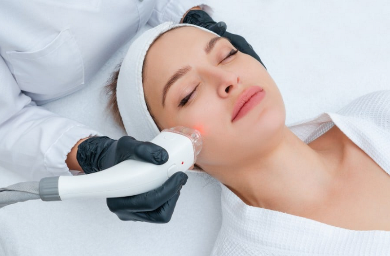 Triệt lông mặt có tốt không? Lợi ích, tác hại & sự thật bạn cần biết