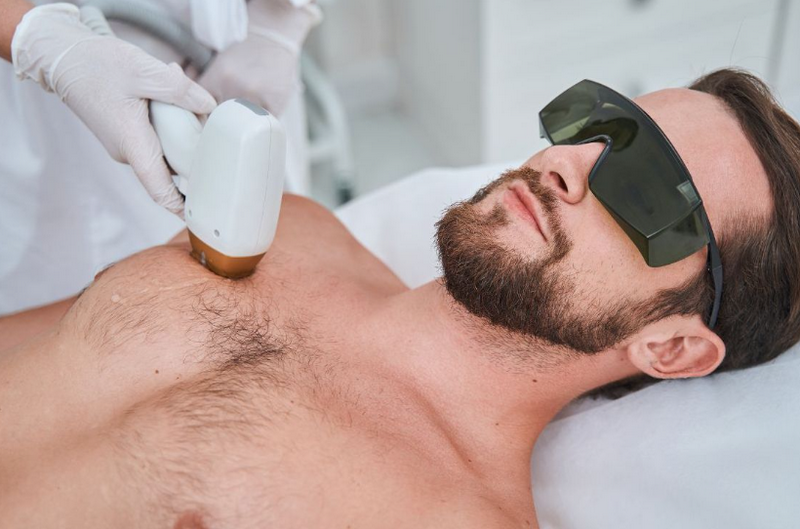 Triệt lông nam: Có nên triệt không? Phương pháp hiệu quả & lưu ý