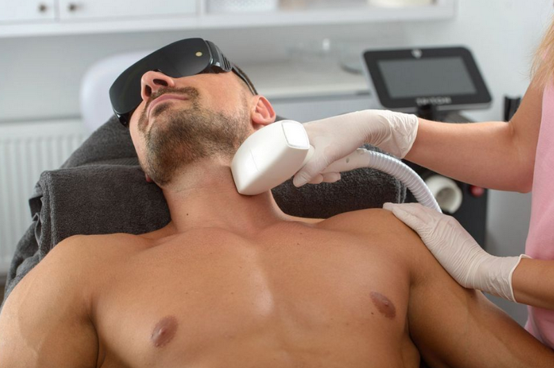 Triệt lông nam: Các phương pháp triệt lông nam giới hiệu quả hiện nay