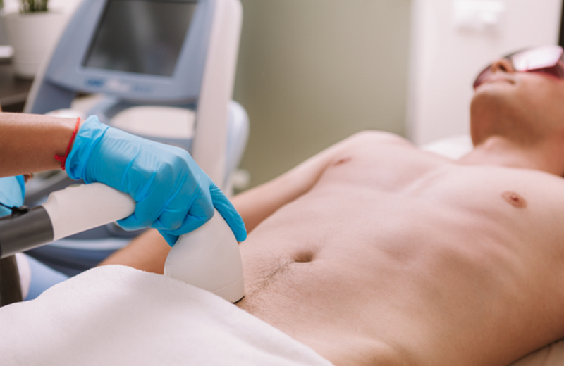 Triệt lông vùng kín nam có vĩnh viễn không? Phương pháp hiệu quả