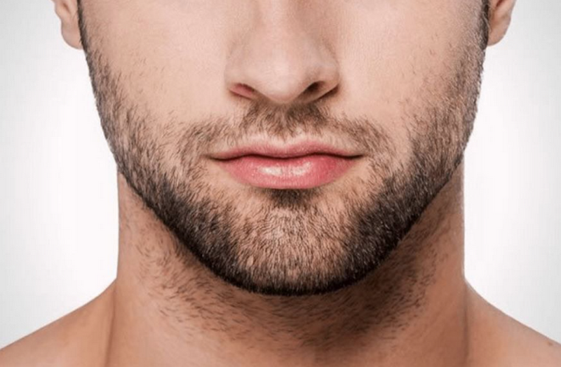 Triệt râu là gì? Các phương pháp triệt râu 