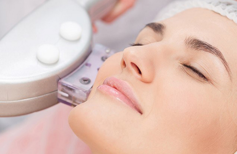 Triệt râu là gì? Các phương pháp triệt râu vĩnh viễn an toàn cho nam và nữ