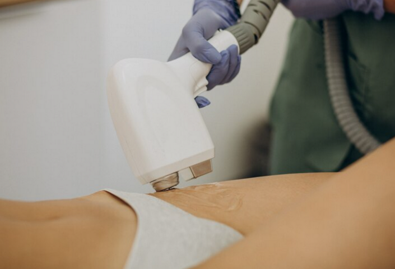 Có nên triệt lông vùng kín không? 