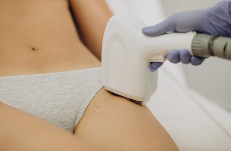 Có nên triệt lông vùng kín không? Lợi ích, tác hại & điều cần biết