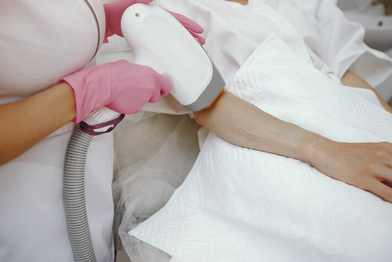 Triệt lông Diode Laser là gì? Có tốt không?