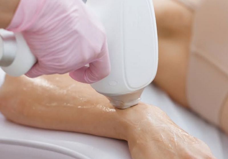 Bảng giá triệt lông tại cơ sở y tế bao nhiêu, có vĩnh viễn không?