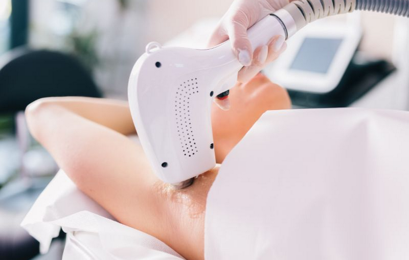 Giá triệt lông nách bao nhiêu? Bảng giá và những yếu tố ảnh hưởng