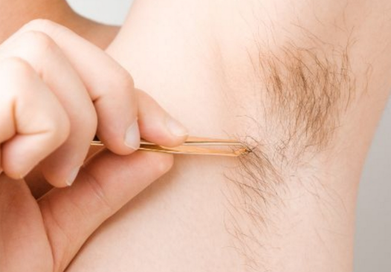 Giá triệt lông nách vĩnh viễn bao nhiêu? Những yếu tố quyết định chi phí
