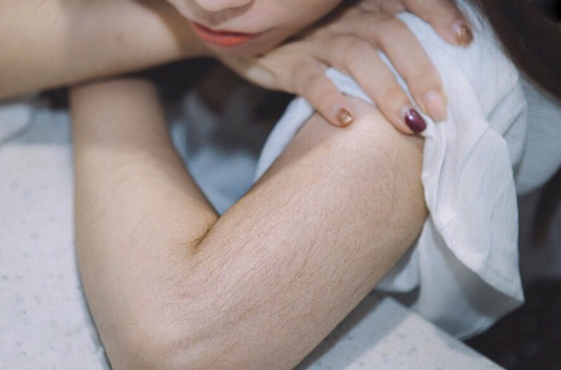 Triệt lông tay là gì? 