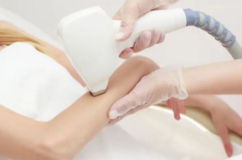 Triệt lông tay là gì? Phương pháp giúp da mịn màng, sạch lông lâu dài