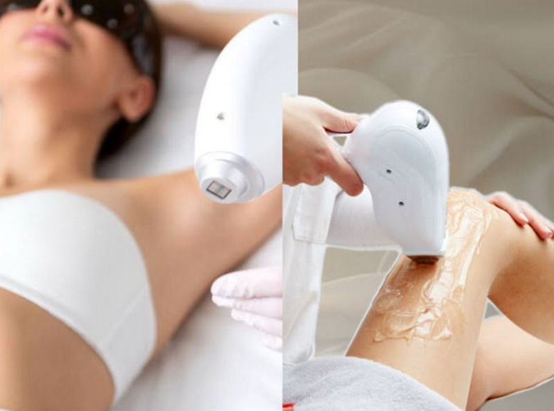 Triệt lông toàn thân gồm những vùng nào? Có tốt không? Hiệu quả?