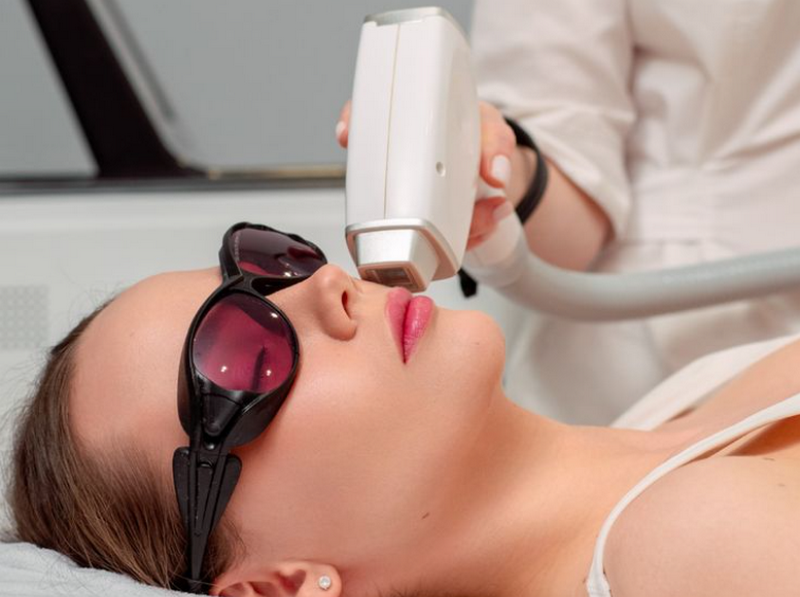 Triệt lông bằng laser: Nguyên lý hoạt động, ưu điểm và những lưu ý cần biết
