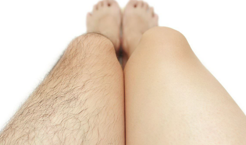 Triệt lông bằng laser: Nguyên lý hoạt động, ưu điểm và những lưu ý cần biết