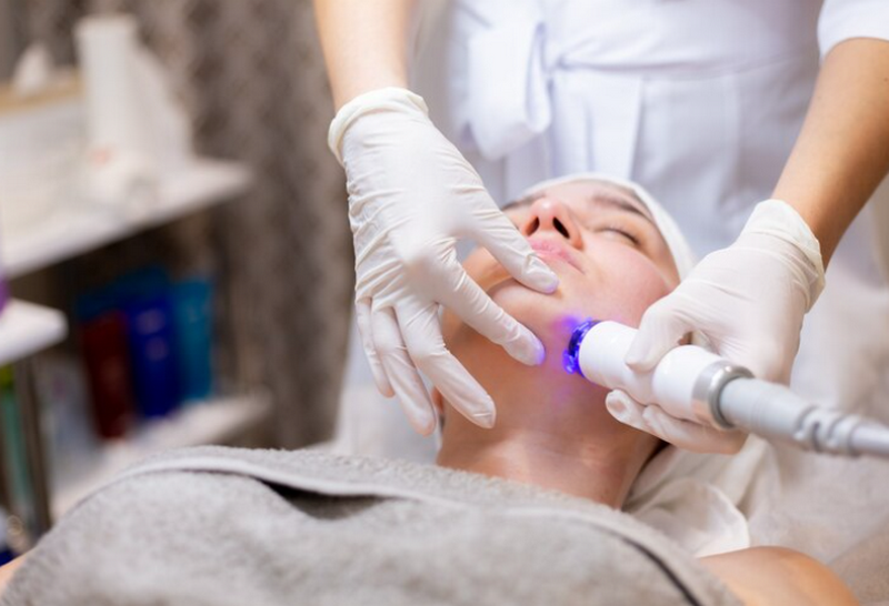 Có nên triệt lông mặt không? Lợi ích, rủi ro và những lưu ý quan trọng