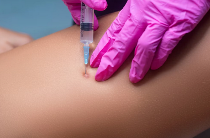 Top mẹo dân gian giúp làm mờ sẹo lồi an toàn, dễ làm