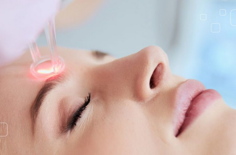 Thẩm mỹ xóa sẹo trên mặt có hiệu quả không? Giải đáp từ chuyên gia