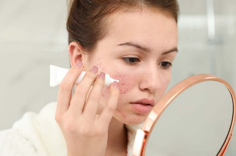 Cách trị sẹo lồi trên mặt hiệu quả, an toàn và sai lầm cần tránh