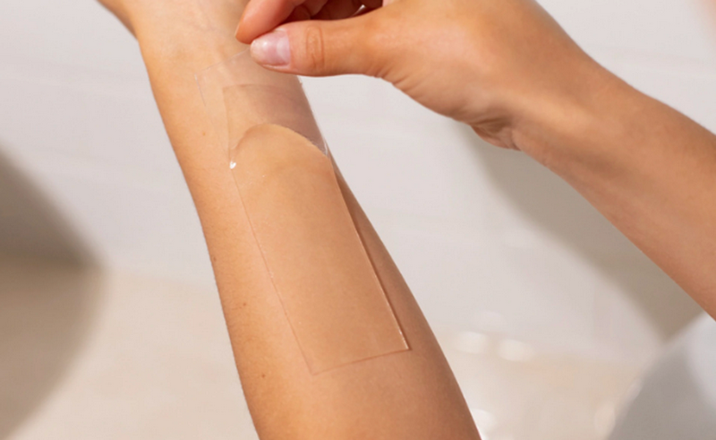 Trị sẹo lồi mới hình thành: Xử lý sớm ngăn sẹo phát triển