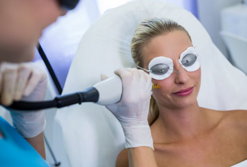 Bắn laser trị sẹo rỗ có hiệu quả? Mức độ cải thiện và rủi ro
