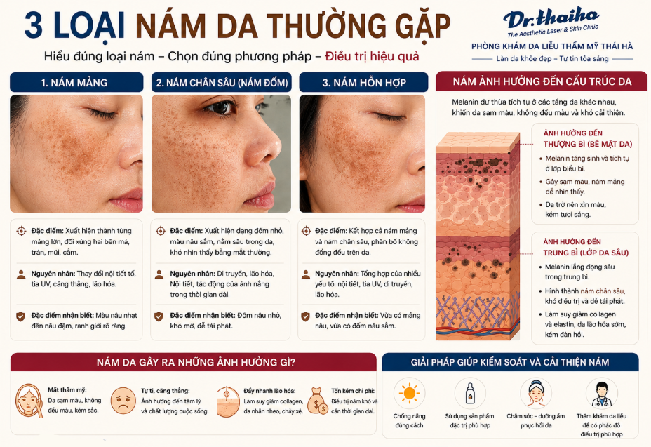 7 phương pháp điều trị nám hiệu quả nhất hiện nay