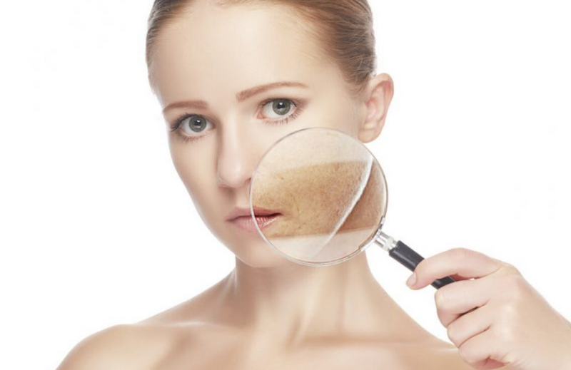 Trị Nám Tàn Nhang: Các Phương Pháp Hiệu Quả Và Cách Lựa Chọn Phù Hợp 