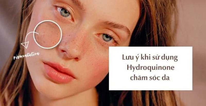 Trị nám tàn nhang tại nhà có hiệu quả không? Điều nên biết trước khi thử