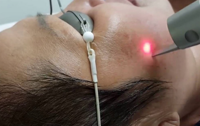 Nám chân đinh có chữa được không?