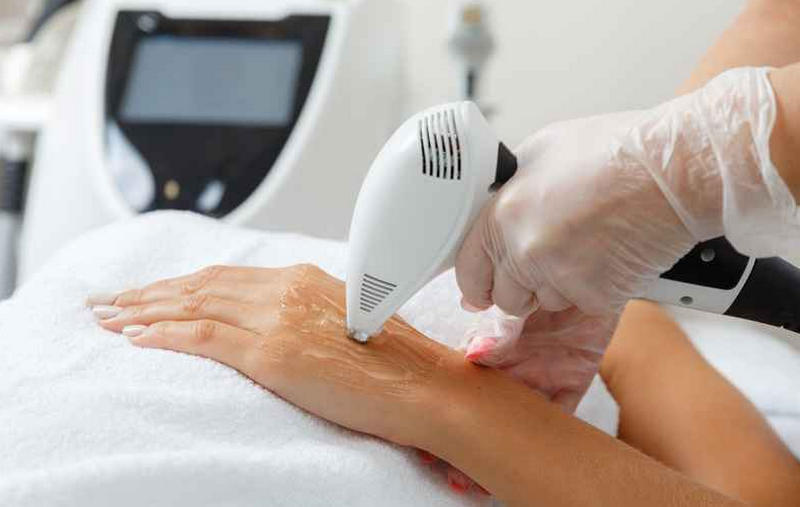 Bị đốm nâu trên da tay như đồi mồi có sao không?