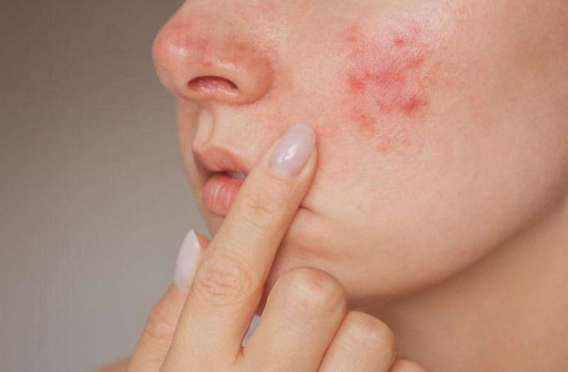 Da sần sùi là bệnh gì? 7 nguyên nhân thường gặp và cách khắc phục hiệu quả