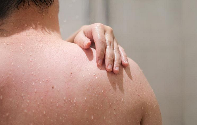 Da khô ráp sần sùi: Nguyên nhân và cách xử lý để da mịn màng