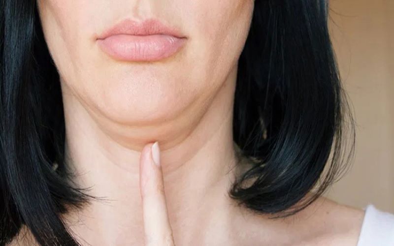 Cách giảm nọng cằm: Chọn đúng phương pháp theo từng nguyên nhân